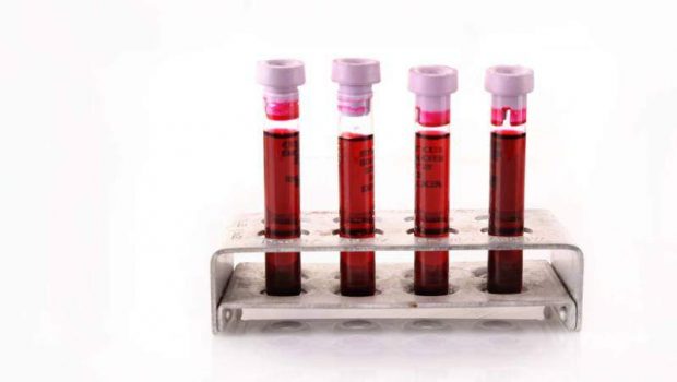Blood cancer