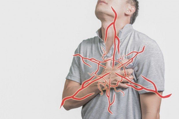 AFib | Longevity LIVE