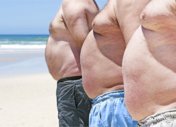 obesity