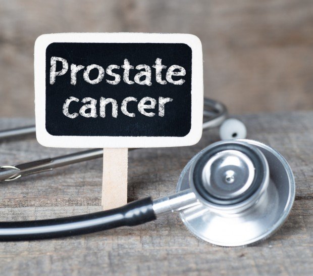 Prostate