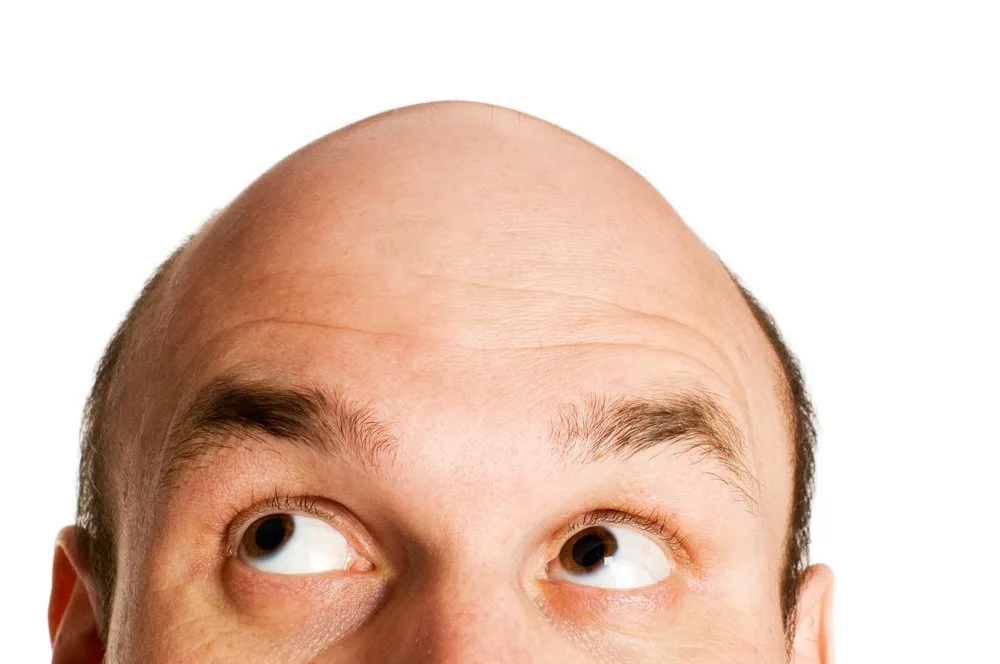 8 Most Common Hair Loss Mistakes Men Make