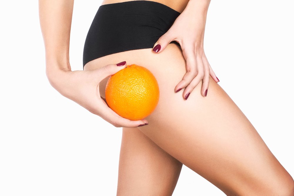 Cellulite in 2019: Causes And Treatments That’ll Work