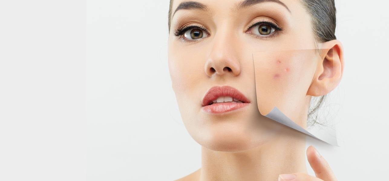 Dr Alek Nikolic on How To Effectively Fade Acne Scars
