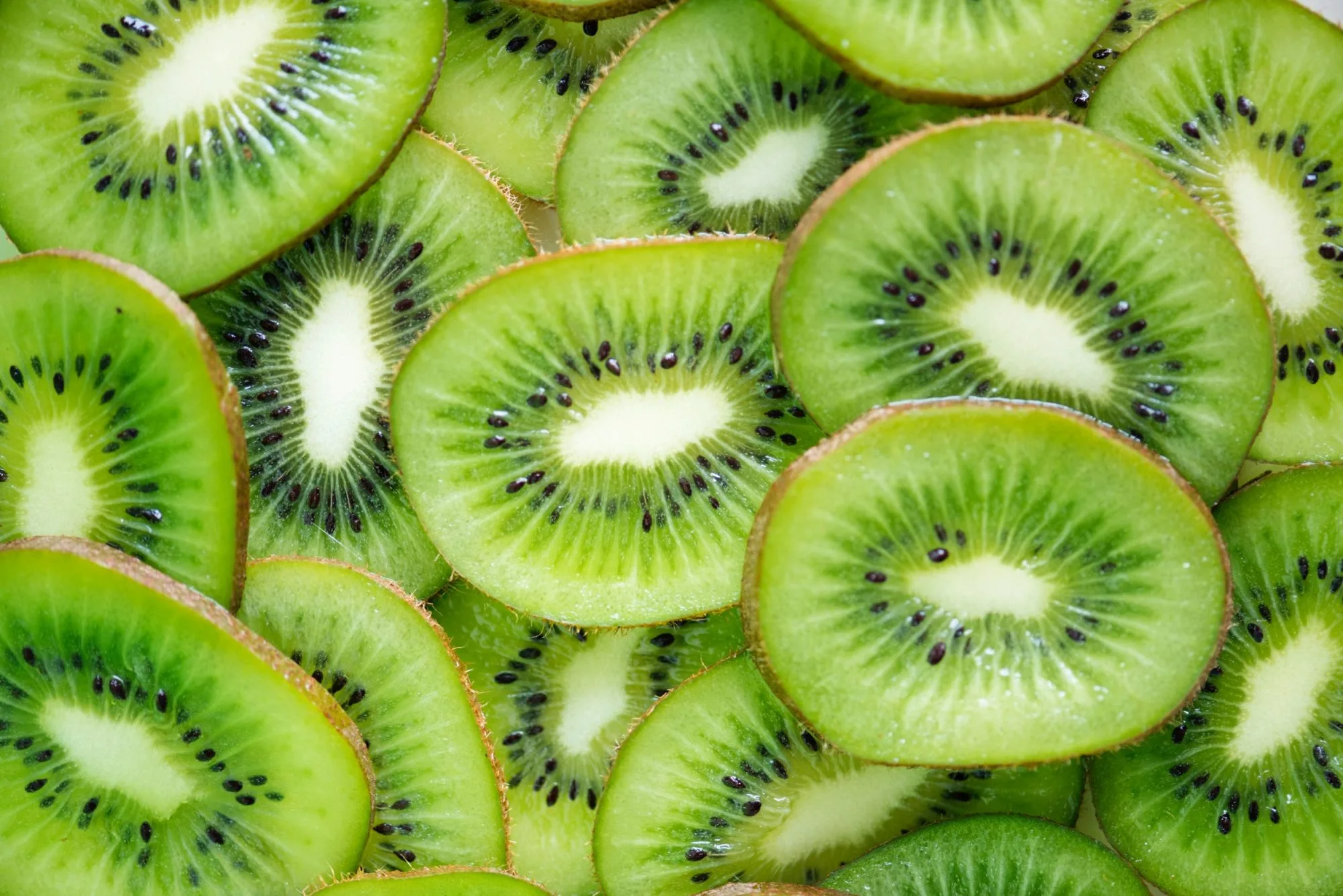 Why Kiwis Should Be On Your Grocery List