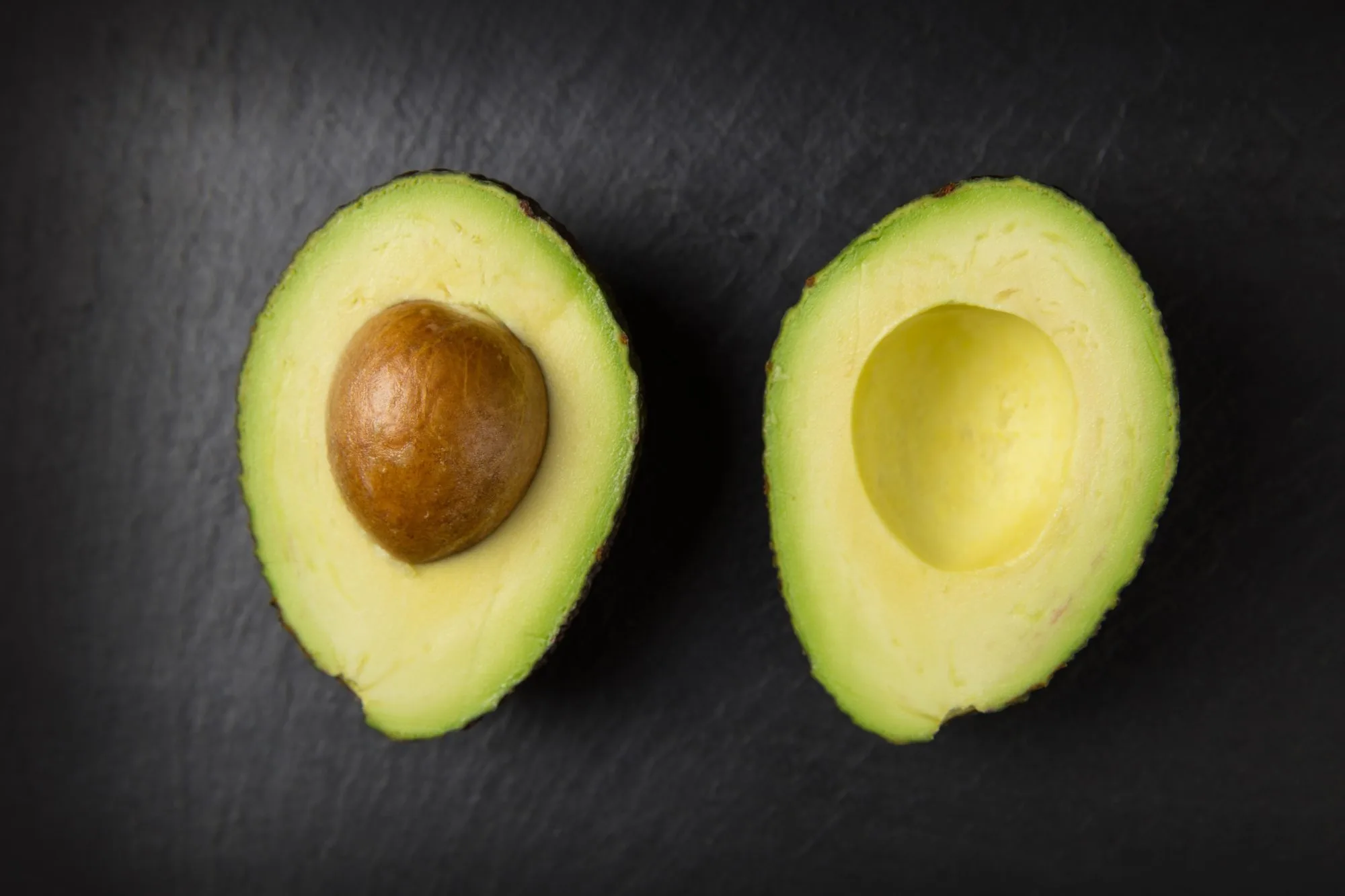 Avocado: What is it and how healthy is it really?