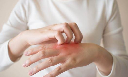 Eczema Is An Inflammatory Disease, Not Just An Irritating Skin Condition