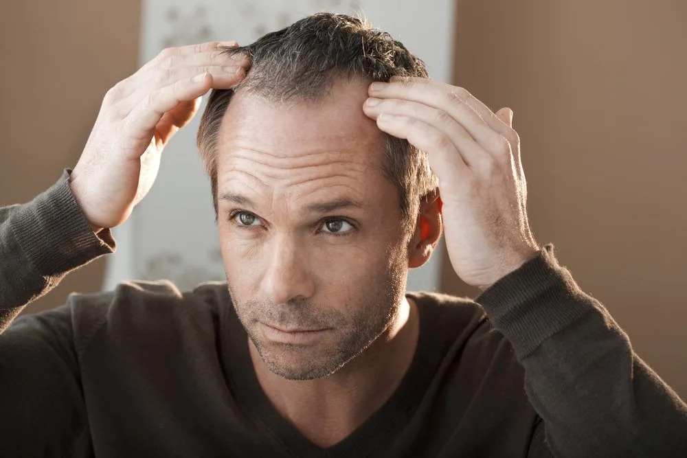 hair loss | Longevity LIVE