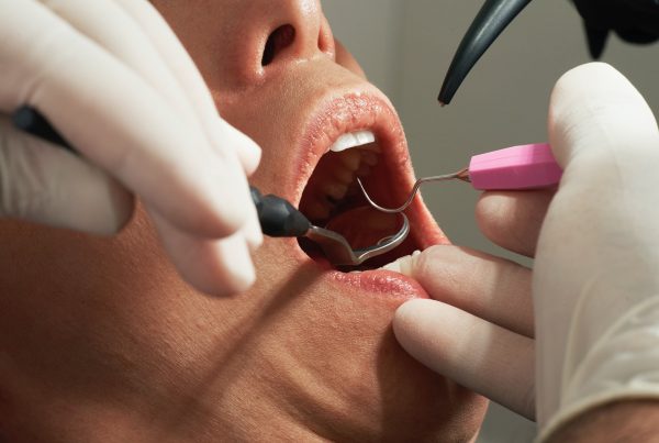 teeth sensitivity