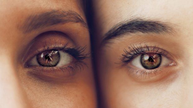 Puffy Eye bags