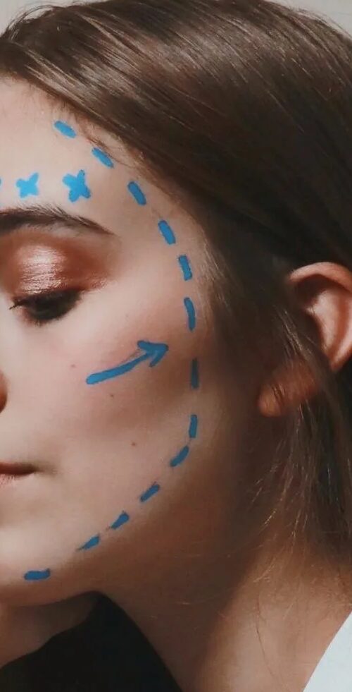 plastic