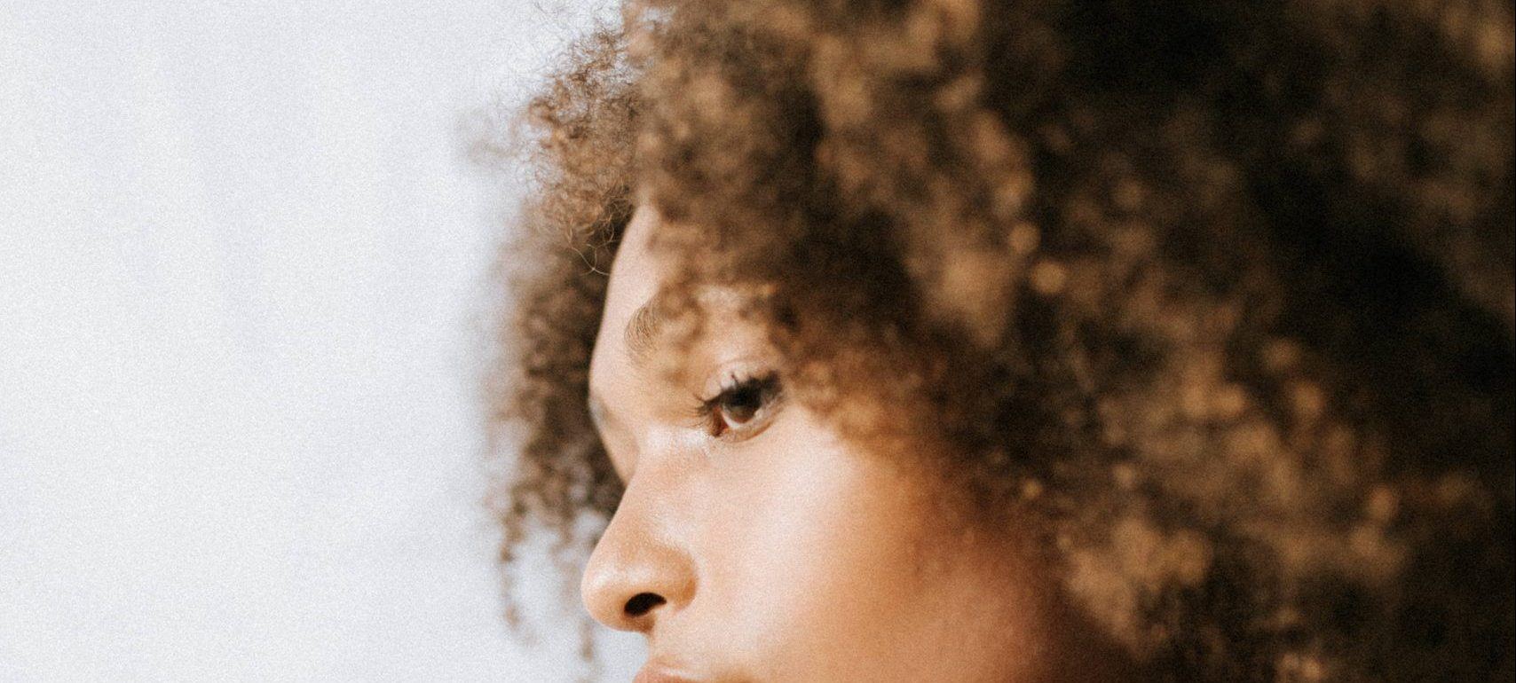 hyperpigmentation