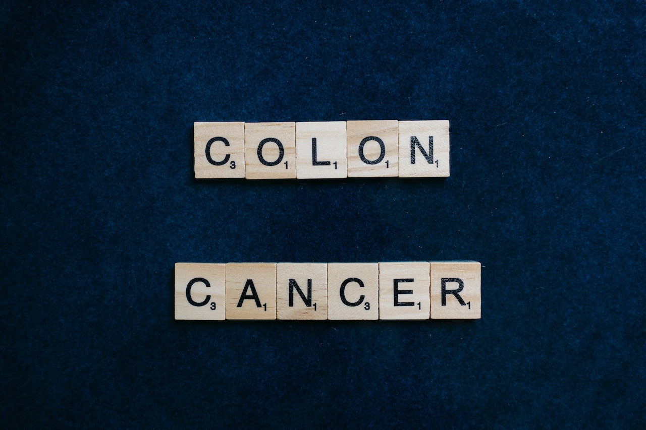 Colon Cancer: A Common But Less Spoken About Cancer
