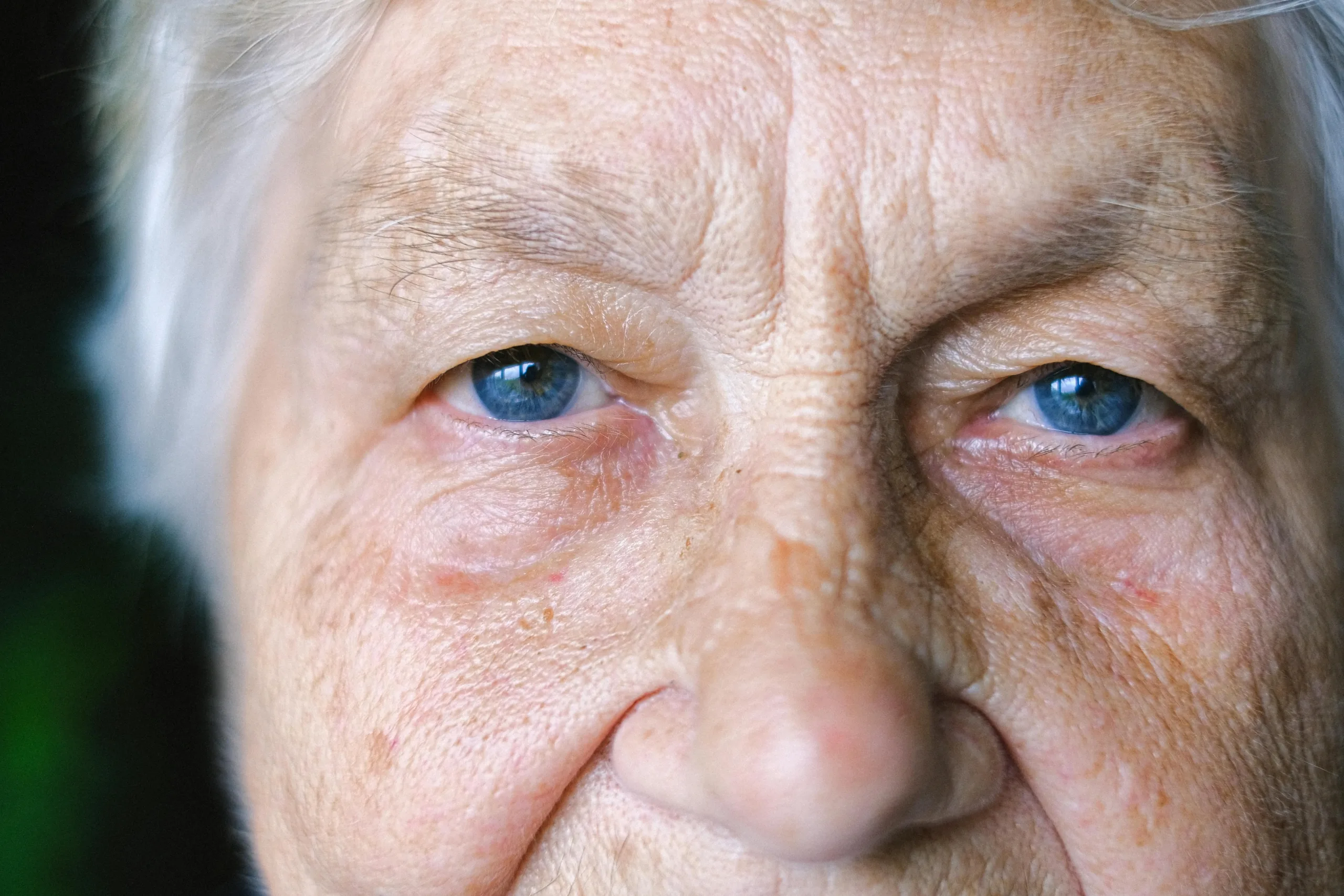The Prevalence of Elder Abuse: Effects, Signs, and More