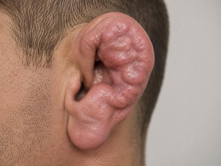 Permanent Injuries Have Become The Newest Symbol of Manhood Online