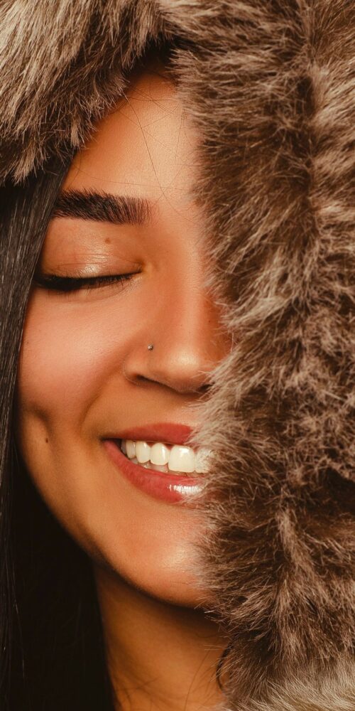 dimples