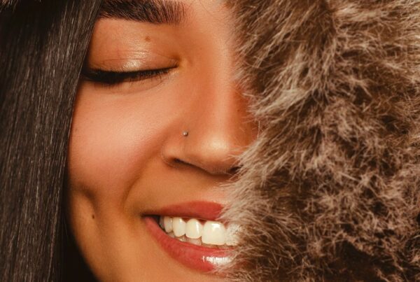 dimples