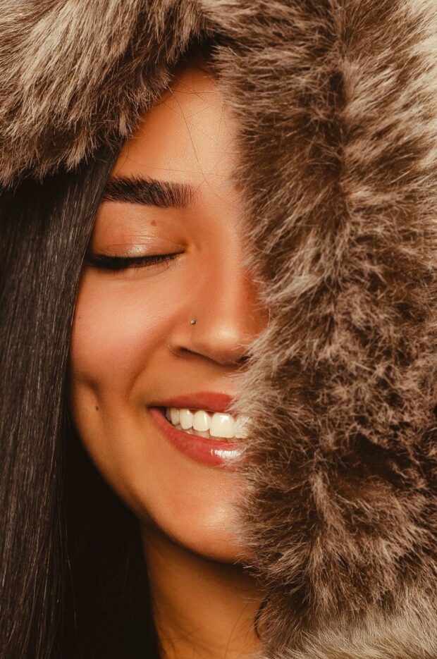dimples
